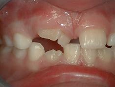 La dentisterie pédiatrique et l’orthodontie: est-ce normal?