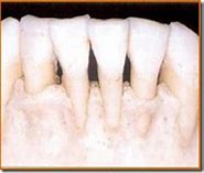 Résorptions et fissures dentaires et Prise en charge efficace des urgences endodontiques