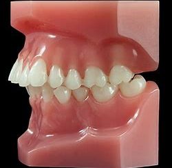 Dépistage, prévention et intervention orthodontique: comment minimiser le coût biologique du traitement orthodontique et chirurgical à l’âge adulte (présentiel)