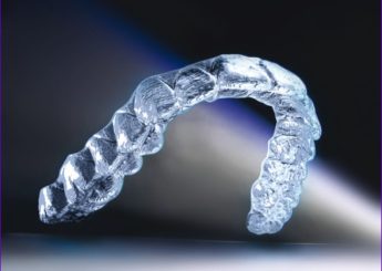 10 trucs et astuces à utiliser avec les aligneurs transparents (en ligne)